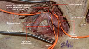 The right subclavian artery arises from the brachiocephalic trunk, while the left the subclavian artery travels laterally towards the axilla. Dissection Of The Collateral Branches Of The Subclavian Artery In The Download Scientific Diagram