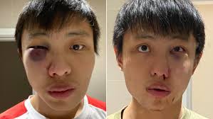 Meet asian singles on asiandating, the most trusted asian dating site with over 4.5 million members. East Asian Student Assaulted In Racist Coronavirus Attack In London Ctv News