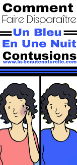 Toutcomment.com vous explique comment cacher un bouton sur le visage de manière simple. Epingle Par Lilibetsileo Saisai Sur Essai Comment Faire Comment Soigner Disparaitre