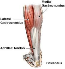 This diagram depicts knee tendon diagram and explains the details of knee tendon diagram. Achilles Tendon Rupture Core Em
