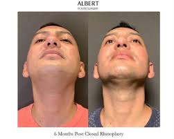 THE BEST 10 PLASTIC SURGEONS near WEEHAWKEN TOWNSHIP, NJ 07086