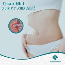A Hernia Umbilical E Uma Protuberancia Instituto Helmont Facebook