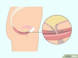 Maybe you would like to learn more about one of these? Manfaat Senam Kegel Untuk Menguatkan Otot Dasar Panggul Wanita
