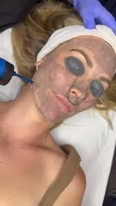 The Hollywood Glow, now at Beauty Secrets Collective , Our Carbon Laser  Facial is like a detox for your skin; shrinking pores, targeting acne, and  boosting your natural glow without downtime. Clearer, ...