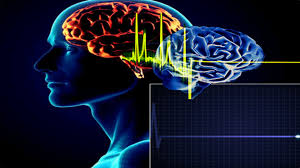 La muerte cerebral es uno de los fenómenos médicos más relevantes , dado que es un estado que sirve como criterio para determinar el punto en el que una persona deja de ser resucitable. Que Es La Muerte Cerebral Y Cuando Se Diagnostica Infobae