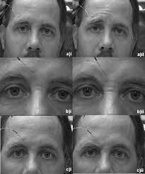 Intramuscular Electrical Stimulation of Facial Muscles in Humans and  Chimpanzees: Duchenne Revisited and Extended