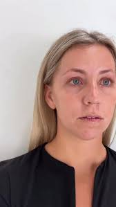 Facial balancing is all about the subtle shifts that make a big difference.  Small, precise adjustments can create a naturally refreshed, beautifully  harmonious look 🤎, Book a consultation 👉 ...