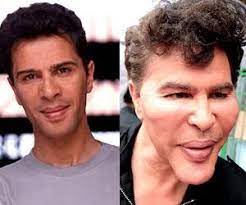 What happened to your face? 20 Celebrity Plastic Surgery Nightmares Celebrity Plastic Surgery Plastic Surgery Plastic Surgery Fail