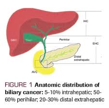 We did not find results for: Biliary Cancer Current Multimodality Treatment And Future Directions