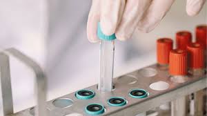 There are many different tumor markers, each indicative of a particular disease process, and they are used in oncology to help detect the presence of cancer. Double Marker Test How It S Done And What Results Mean