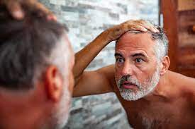 It causes patches of itchy skin and hair loss that may get worse over time. How To Prevent Hair Loss Dandruff And An Itchy Scalp