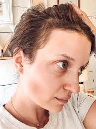 Here's when it will stop and what you can to slow down the shedding. Postpartum Hair Loss These Tips Can Help Carley Schweet