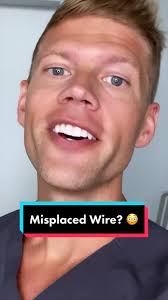 Misplaced Wire? Understanding Braces Wire Placement