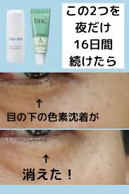 ビフォアフ写真 キャメロン ガブリエル天使の聖水とｄｈｃレチノａエッセンスを16日間使った結果 スキンケア プチプラ レチノール 目の下のくま