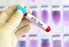 Was tun bei veränderter ptt? Partial Thromboplastin Time Ptt Test Levels Procedure Results