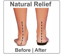 Pin On Fascia Plantar