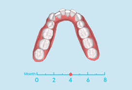 Sunshinesmile Beratungszentren Medizintechnik Gerade Zahne Zahnschiene