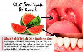 Prevpreviouskulit kusam sebab pernah terkena sihir & santau? Cara Melegakan Sakit Tekak Petua Hilangkan Sakit Tekak Tazkirah Ustaz Ebit Lew Facebook Cara Melegakan Sakit Tekak Dengan Hisap Bawang Putih Halamancity