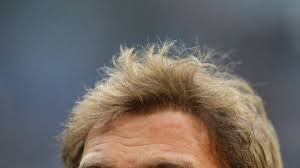 Schon im januar überraschte der trainer von borussia dortmund bereits mit einer schicken neuen kurzhaarfrisur. Bvb Trainer Klopp Liess Sich Haare Transplantieren Panorama