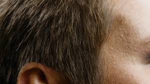 If you're dealing with hair loss on your eyebrows, you can't solve the problem without the right products to accelerate growth. Prostaglandins For Hair Growth A Potential Hair Loss Treatment Hairverse