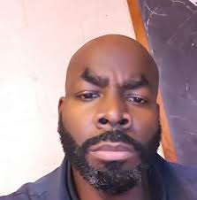 I've been doing in center for 7 years and I have mastered fluid intake,  even during the summer months. I skipped treatment Wednesday and only put 