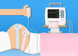 Image result for Non-Stress Test