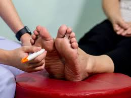 Toe numbness can also result from infection, inflammation, trauma, malignancy, and other abnormal processes. Diabetic Neuropathy Types Symptoms And Causes