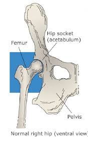 This article addresses hip dislocation that results from a traumatic injury. Pin On Hip Abductiona Brace