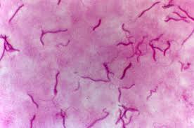 The similarities extended to the other physical properties, the antimicrobial activity against staphylococcus aureus and sarcina lutea, and. Spirillum Volutans Spiral Shaped Singly Gram Spiral Shape Drupal Microbiology