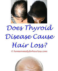 Cat Allergies That Cause Hair Loss Full Body Hair Loss Causes New Study Hair L Allergies Body Body Hair Loss Hair Loss Reasons Hair Loss In Children