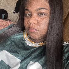 What can I do to relieve severe back pain during pregnancy?