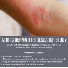 Image result for Rhus Dermatitis