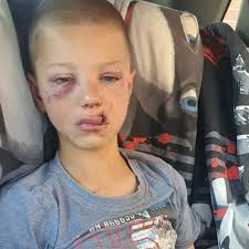 When their family dog attacked her son this Joburg mom didn't hesitate to  save her boy