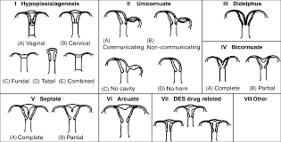 The more eggs a woman has, the higher her amh level. Mullerian Anomalies Chapter 3 Reproductive Surgery