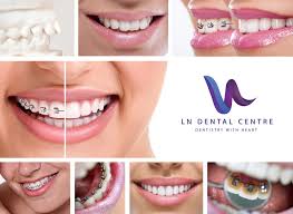 The cost of lingual braces start at approximately $7,500 for a single arch and from $12,500 for a full treatment. Can I Get Braces On The Top Or Bottom Teeth Only Ln Dental Centre