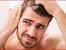 How To Prevent Hair Fall For Male