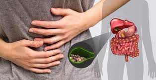 One cleanse involves mixing apple cider vinegar into the apple juice before drinking it. Gallstones Symptoms Causes Natural Treatments Dr Axe