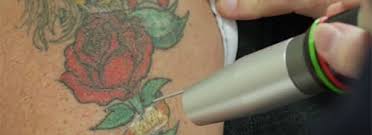 Our teachers have been working in this sector for many years, and are skilled at imbuing our students. Certified Laser Ipl Operator Training Courses