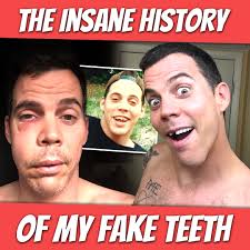 Steve-O