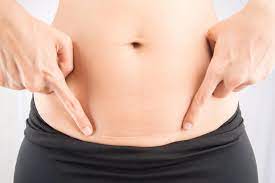 My C Section Scar Suddenly Started Itching Is That Normal