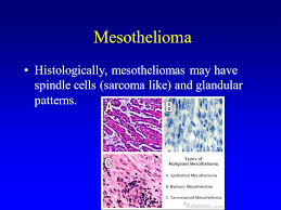 Mesotheliomas are classified into 4 main histologic types: Tumors Of The Lung And Upper Respiratory Tract Ppt Video Online Download
