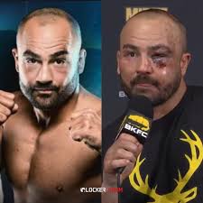Eddie Alvarez Before and After his BKFC fight against Mike Perry 👀  #EddieAlvarez #MikePerry #BKFC #MMA #MMANews #UFCNews #FightNews  #FightUpdates #BKFC #PlatinumPerry #Injury