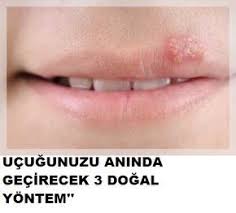 Pin On Saglik