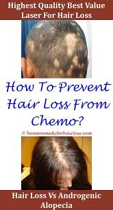Vitamin d is essential for healthy bones, and a lack of it can lead to health problems, including cardiovascular disease. Hair Loss Vitamin D Deficiency Causes