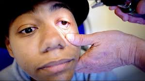 HE HAS BAD SEASONAL ALLERGIES! (He Also Has an Irregular Heart Beat  (Arrhythmia)| Dr. Paul