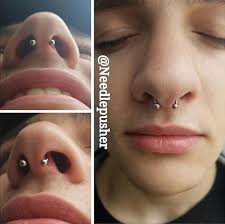 How to change your nose shape. Does Fixing A Deviated Septum Change The Shape Of Your Nose Pictures Rhinoplasty Cost Pics Reviews Q A