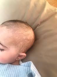 In other babies, it takes a while to grow back. 4month Girls Hair Not Grown Yet December 2018 Babies Forums What To Expect