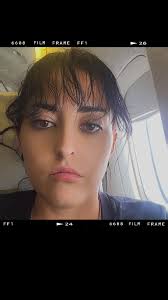 Making a query from Australia; are there any RLD practitioners in the Leeds  area? Making a query for my cousin who has lymphadema following a radical  madtectomy😊