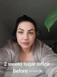 What Two Weeks of No Sugar Did to Jy Face