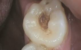 General and emergency dental in wateford plaza, perth. 3yjmvv0aroqhmm